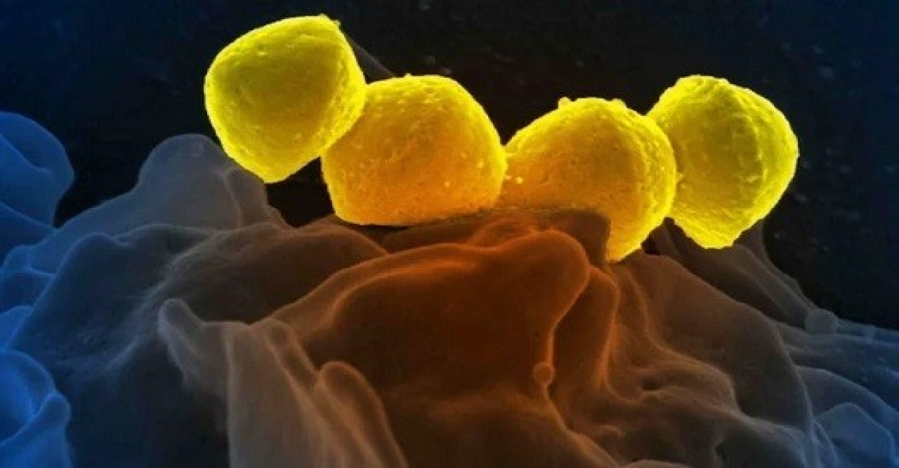 জাপানে ছড়িয়ে পড়ছে ‘মাংসখেকো ব্যাকটেরিয়া’ জাপানে ছড়িয়ে পড়ছে ‘মাংসখেকো ব্যাকটেরিয়া’