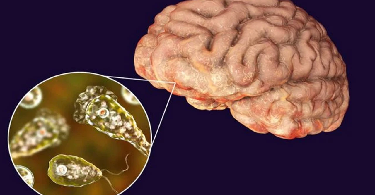 ব্রেইন-ইটিং অ্যামিবা কেরালায় আতঙ্ক: এক মাসে ৩ জনের মৃত্যু, শিশু ও নারীও আক্রান্ত