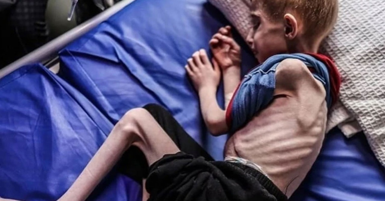 গাজায় ক্ষুধার্ত শিশুদের মৃত্যুমিছিল, পশ্চিমা সমর্থনে অব্যাহত ইসরায়েলি নৃশংসতা